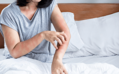 How to Remove Bed Bugs From Clothes in Las Vegas